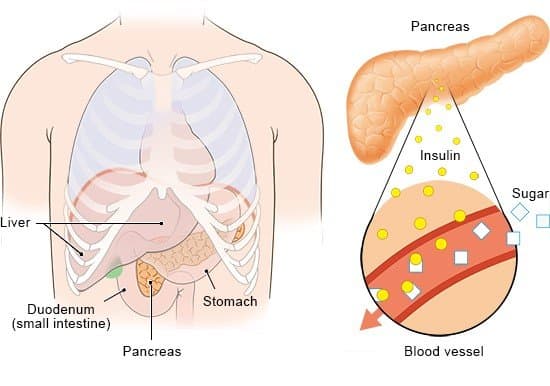 Diabetes Type 2 Reversal